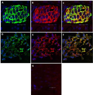 From Mesenchymal Stromal/Stem Cells to Insulin-Producing Cells: Immunological Considerations